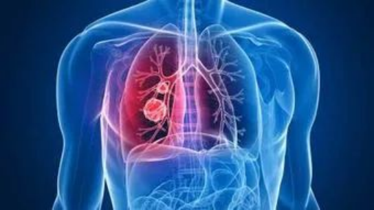 干细胞对抗肺部疾病，让呼吸不再艰难