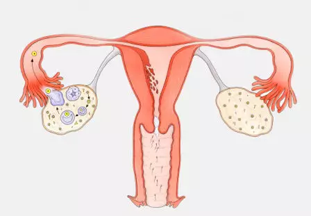 干细胞移植让女性芳华永驻，推迟进入更年期