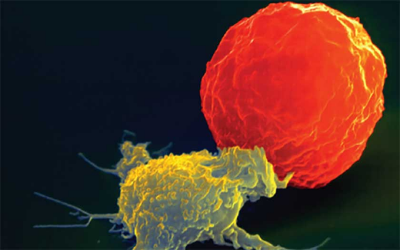 抗癌新能量—NK细胞精准治癌