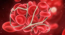 脐带血干细胞存储